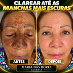 VERON™ Kojic Flash Extreme