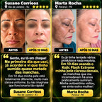 VERON™ Kojic Flash Extreme